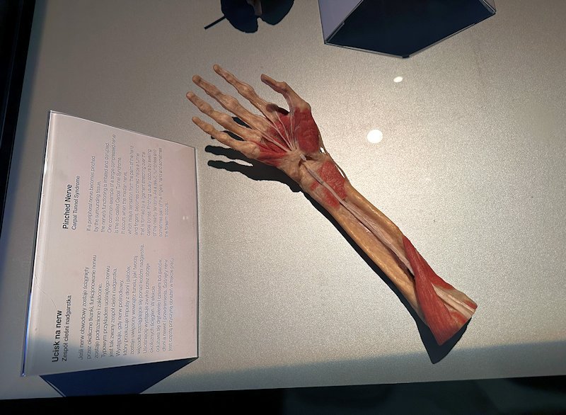 Wycieczka na wystawę Body Worlds - Circle of Life